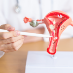 Doctor pointing to a model of a uterus